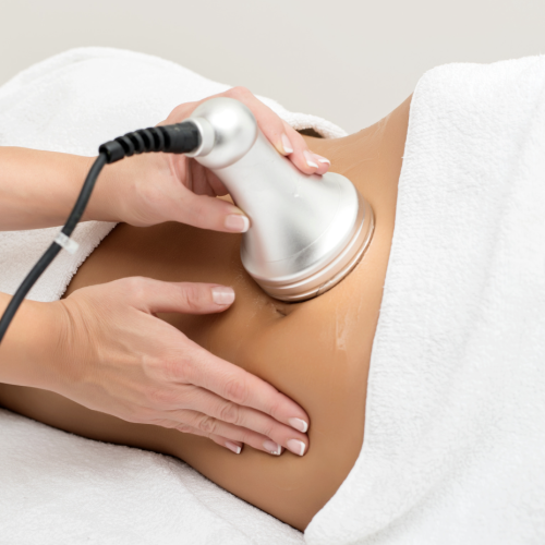 radio frequency treatment illustration
